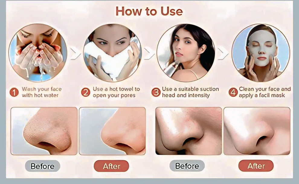 Portable Blackhead Remover™ | Deep Clean, Smooth Skin