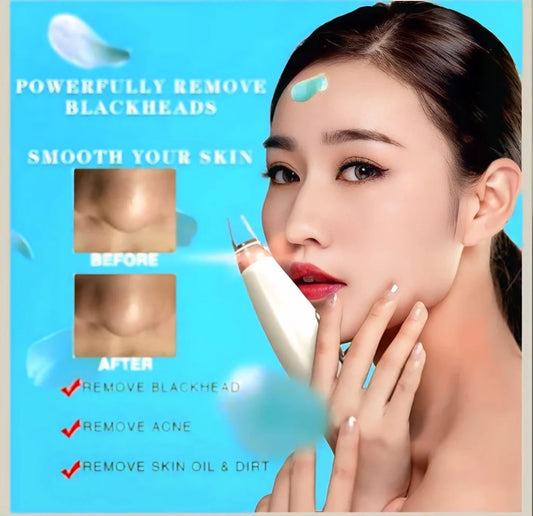 Portable Blackhead Remover™ | Deep Clean, Smooth Skin
