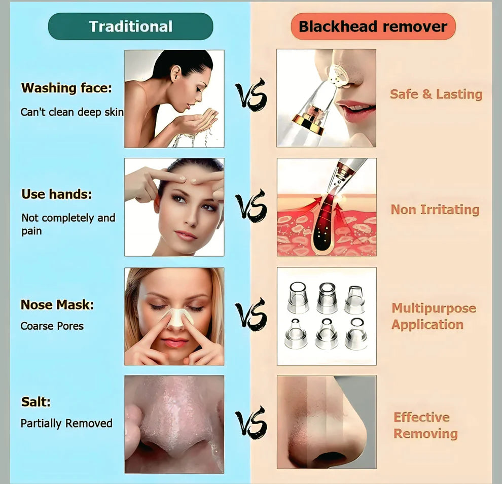 Portable Blackhead Remover™ | Deep Clean, Smooth Skin
