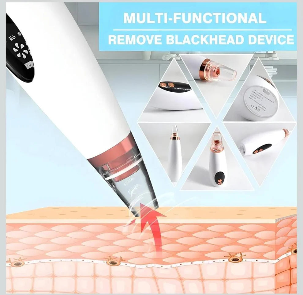 Portable Blackhead Remover™ | Deep Clean, Smooth Skin